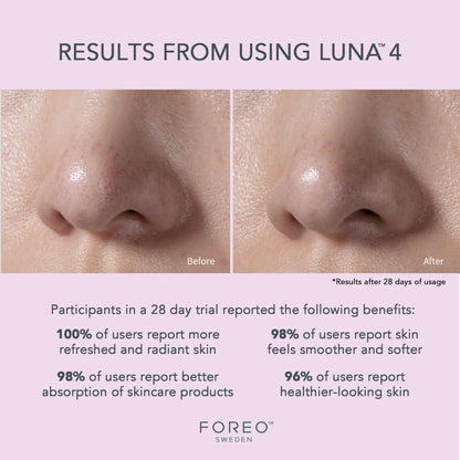 FOREO LUNA™ 4