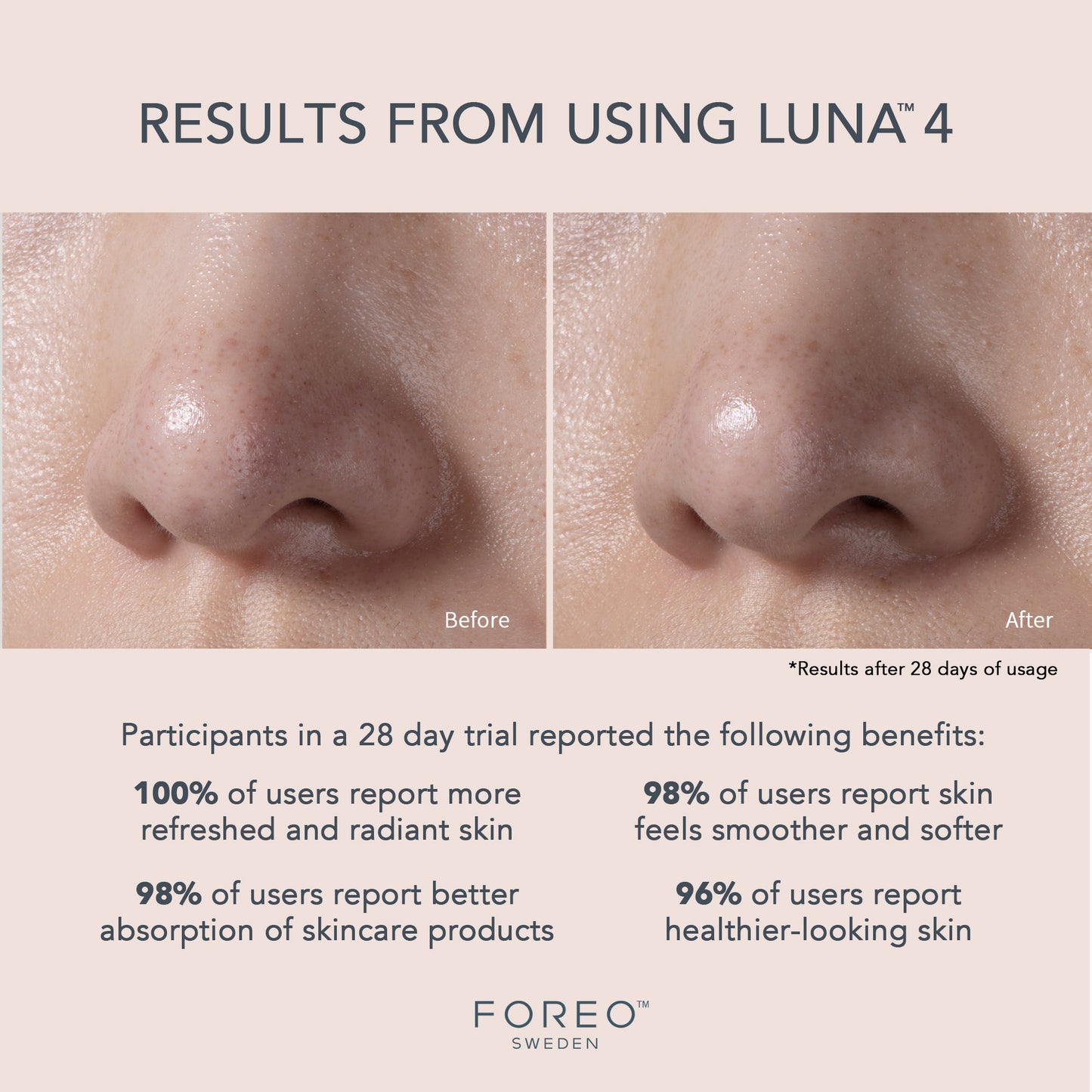 FOREO LUNA™ 4