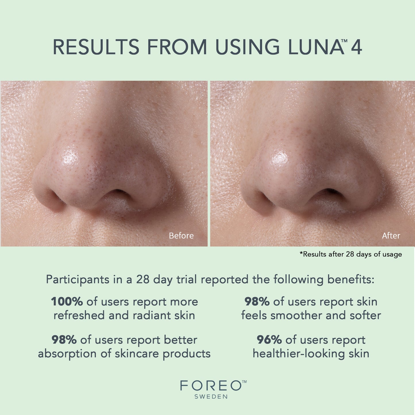 FOREO LUNA™ 4