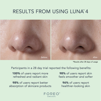 FOREO LUNA™ 4