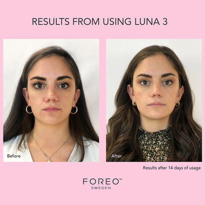 FOREO LUNA™ 3